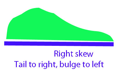 right skew